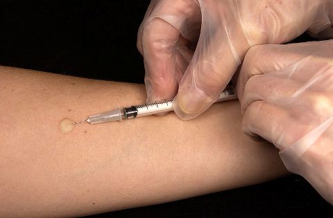 Tử vong tại nhà thuốc tư sau khi tiêm thuốc trợ tim